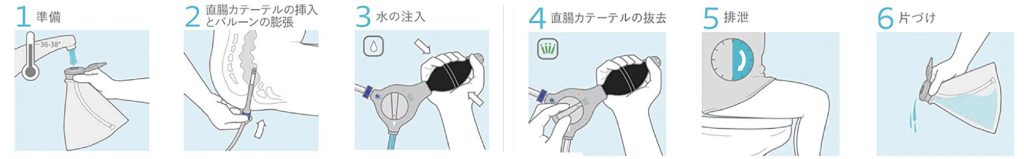洗腸の手順6ステップ